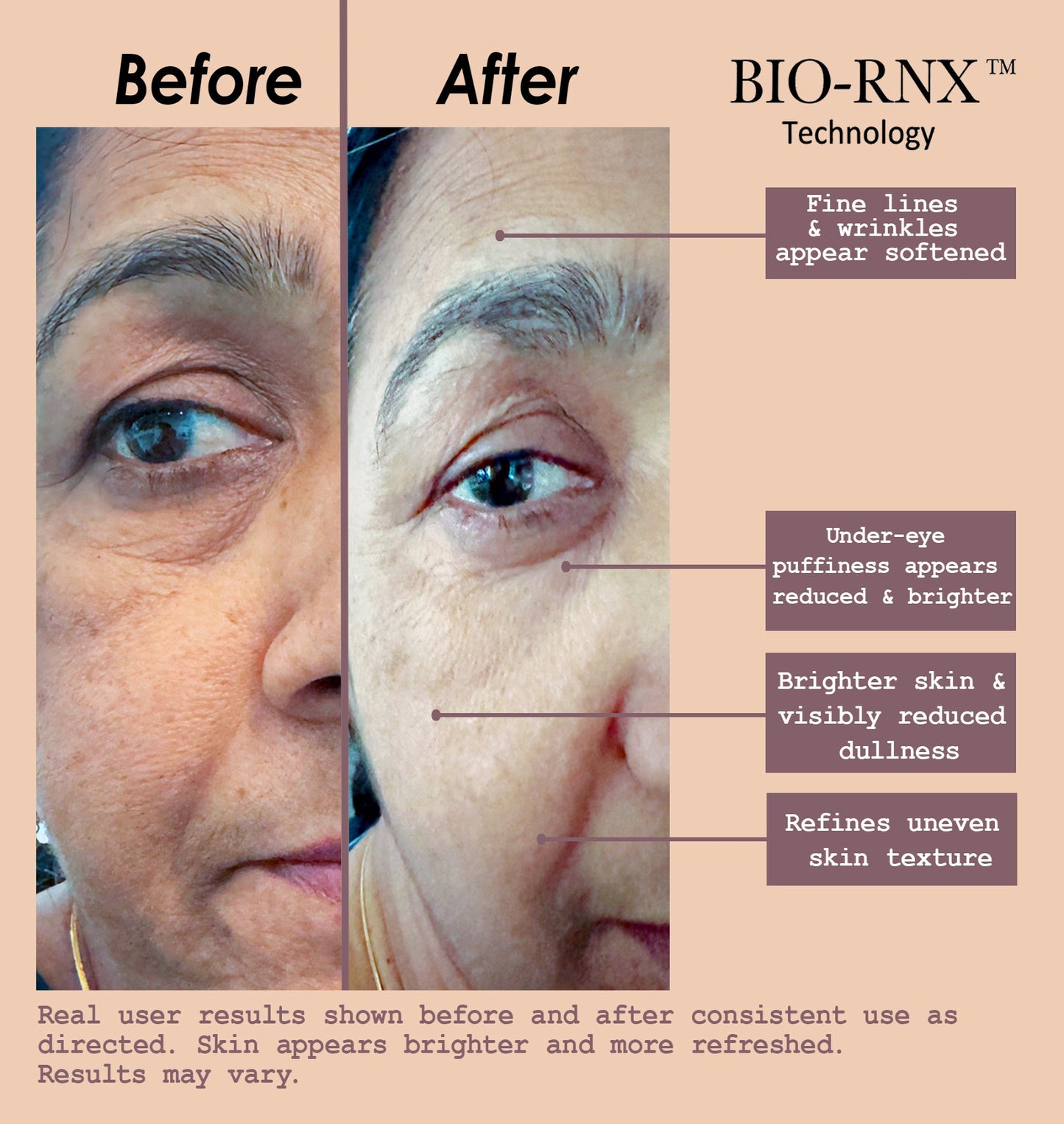 LumaSera Advanced Youth Serum,Multi Peptides+Multi Growth Factors, PDRN+EGF+Vitamin B3+Human Fibroblast Condition Media+Copper Peptides, Targets 8 Signs of Visible Aging, BIO-RNX™ Technology